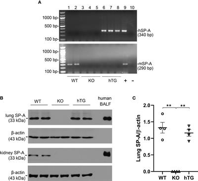 Regulatory roles of SP-A and exosomes in pneumonia-induced acute lung and kidney injuries